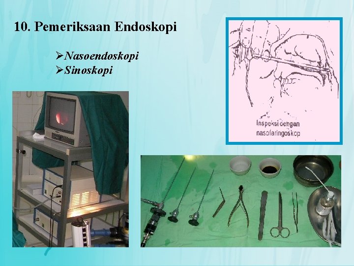 10. Pemeriksaan Endoskopi ØNasoendoskopi ØSinoskopi 