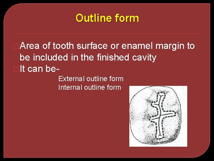 Outline form �Area of tooth surface or enamel margin to be included in the