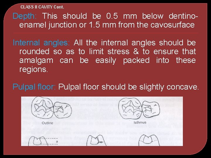 CLASS II CAVITY Cont. Depth: This should be 0. 5 mm below dentinoenamel junction