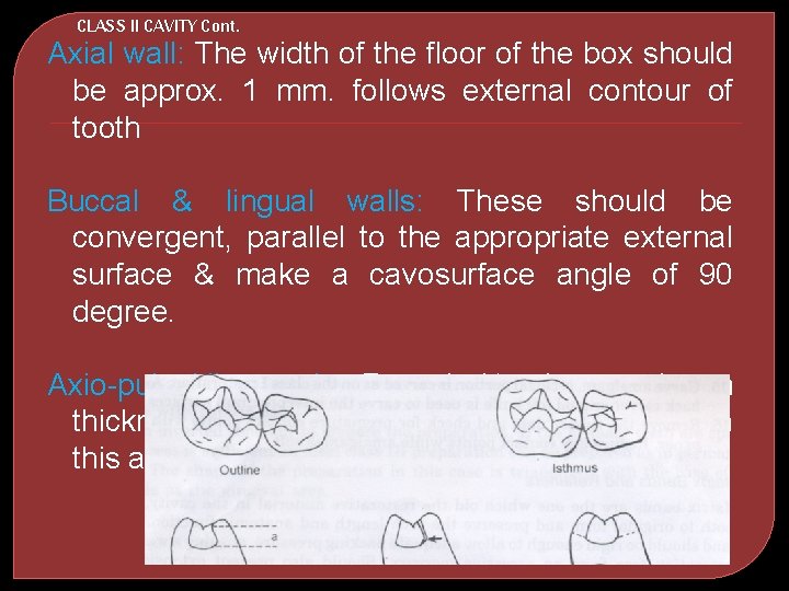 CLASS II CAVITY Cont. Axial wall: The width of the floor of the box