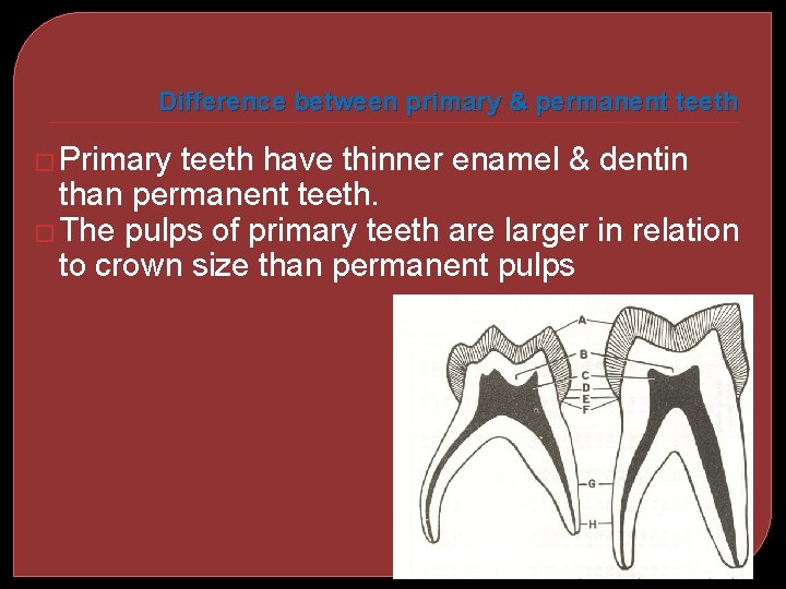 Difference between primary & permanent teeth � Primary teeth have thinner enamel & dentin