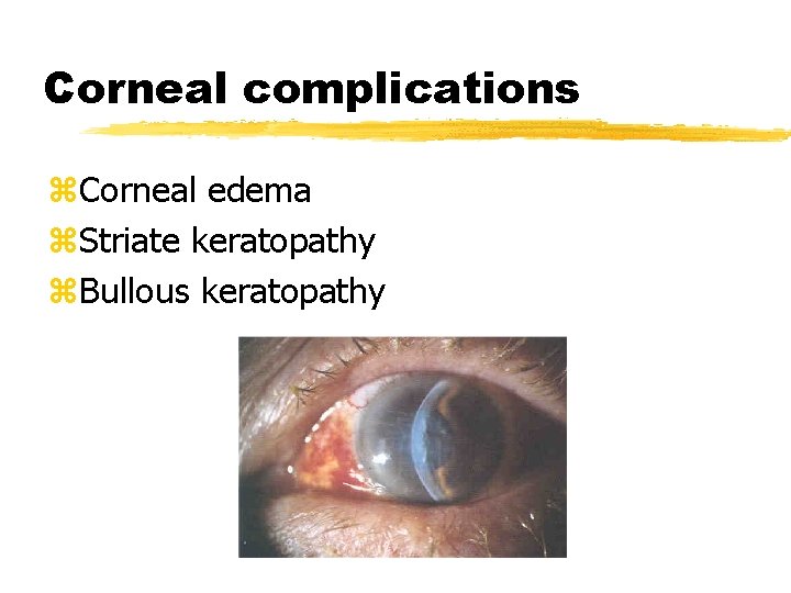 Corneal complications z. Corneal edema z. Striate keratopathy z. Bullous keratopathy 