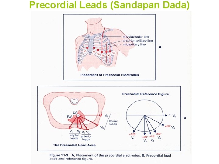 Precordial Leads (Sandapan Dada) 