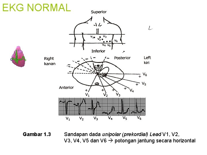 EKG NORMAL Gambar 1. 3 Sandapan dada unipolar (prekordial) Lead V 1, V 2,