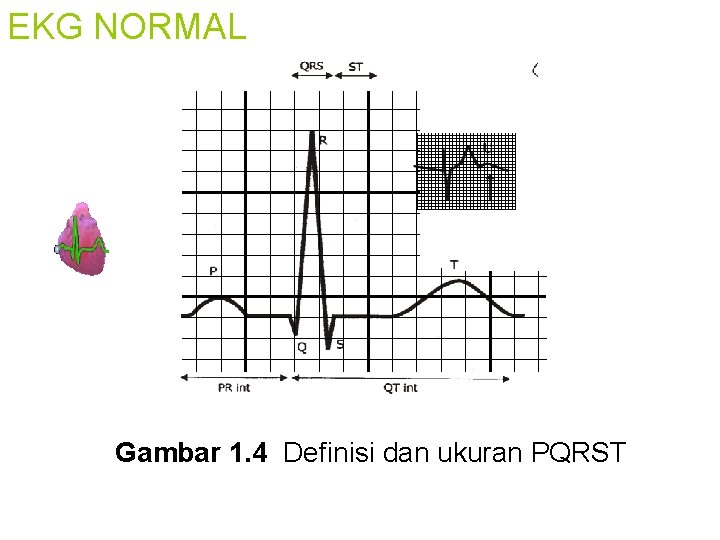 EKG NORMAL Gambar 1. 4 Definisi dan ukuran PQRST 