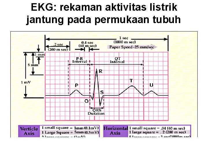 EKG: rekaman aktivitas listrik jantung pada permukaan tubuh 