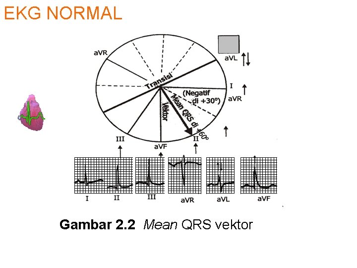 EKG NORMAL Gambar 2. 2 Mean QRS vektor 