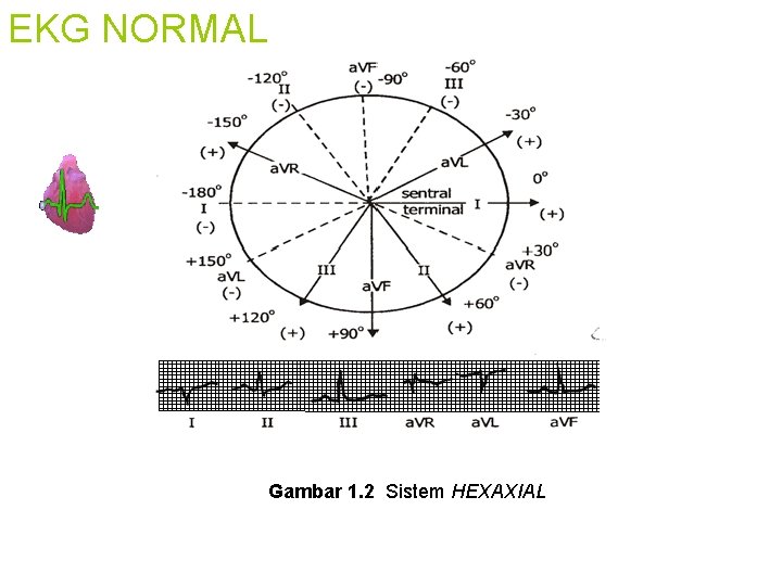 EKG NORMAL Gambar 1. 2 Sistem HEXAXIAL 