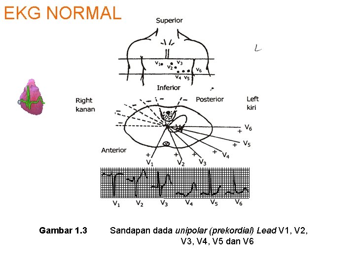 EKG NORMAL Gambar 1. 3 Sandapan dada unipolar (prekordial) Lead V 1, V 2,