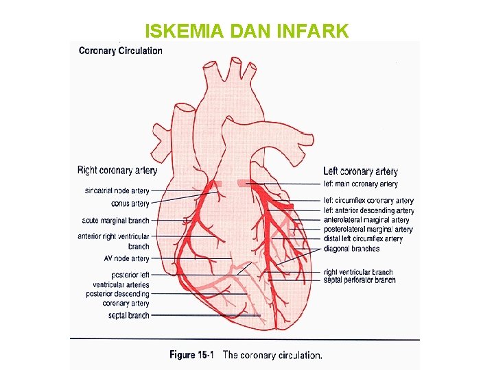 ISKEMIA DAN INFARK 