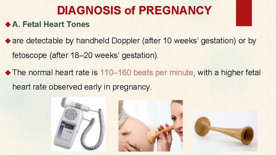 DIAGNOSIS of PREGNANCY A. Fetal Heart Tones are detectable by handheld Doppler (after 10