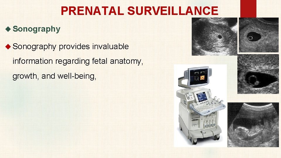 PRENATAL SURVEILLANCE Sonography provides invaluable information regarding fetal anatomy, growth, and well-being, 