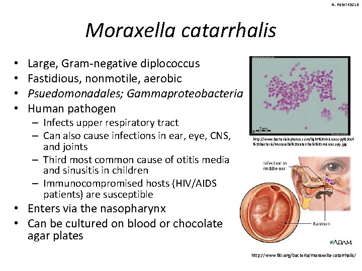 N. Patel F 2013 Moraxella catarrhalis • • Large, Gram-negative diplococcus Fastidious, nonmotile, aerobic