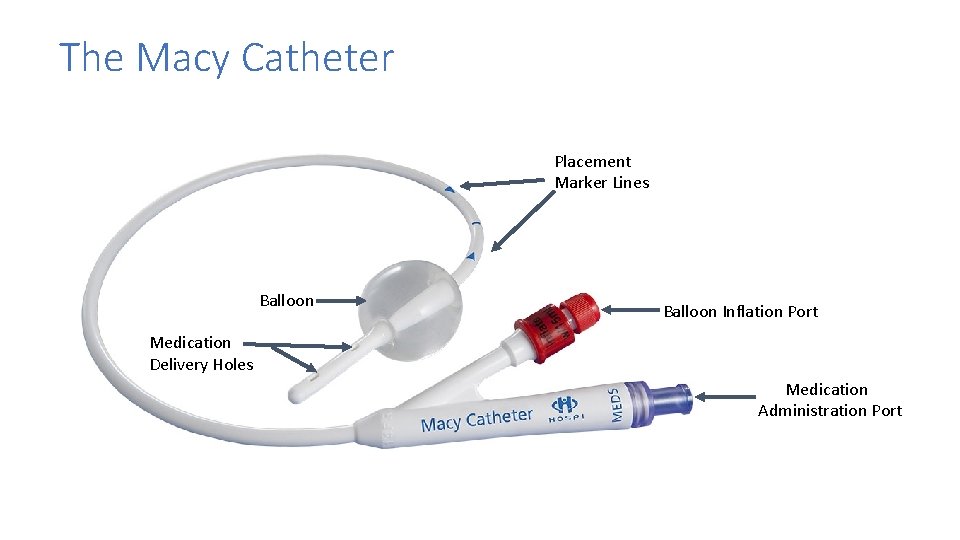 The Macy Catheter Placement Marker Lines Balloon Inflation Port Medication Delivery Holes Medication Administration The Macy Catheter Placement Marker Lines Balloon Inflation Port Medication Delivery Holes Medication Administration