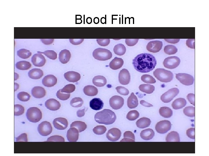 Blood Film 