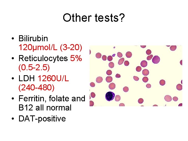 Other tests? • Bilirubin 120μmol/L (3 -20) • Reticulocytes 5% (0. 5 -2. 5)
