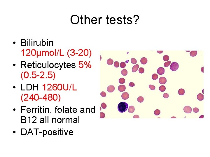 Other tests? • Bilirubin 120μmol/L (3 -20) • Reticulocytes 5% (0. 5 -2. 5)