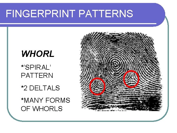 FINGERPRINT PATTERNS WHORL *’SPIRAL’ PATTERN *2 DELTALS *MANY FORMS OF WHORLS 