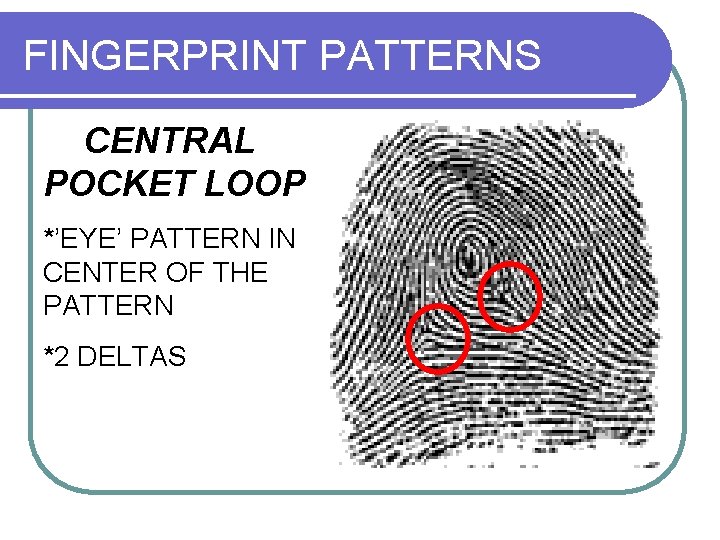 FINGERPRINT PATTERNS CENTRAL POCKET LOOP *’EYE’ PATTERN IN CENTER OF THE PATTERN *2 DELTAS