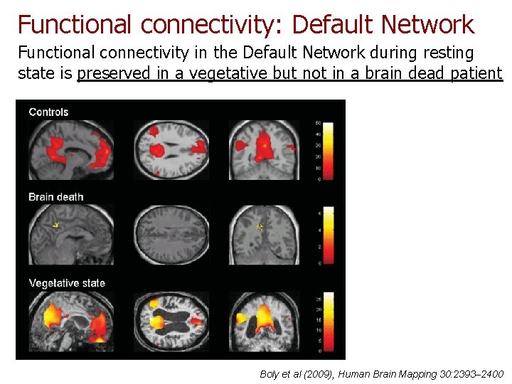 Functional connectivity: Default Network Functional connectivity in the Default Network during resting state is Functional connectivity: Default Network Functional connectivity in the Default Network during resting state is