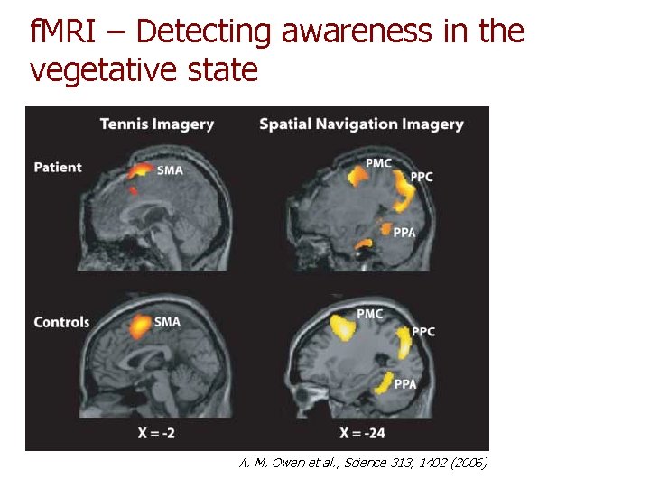 f. MRI – Detecting awareness in the vegetative state A. M. Owen et al. f. MRI – Detecting awareness in the vegetative state A. M. Owen et al.