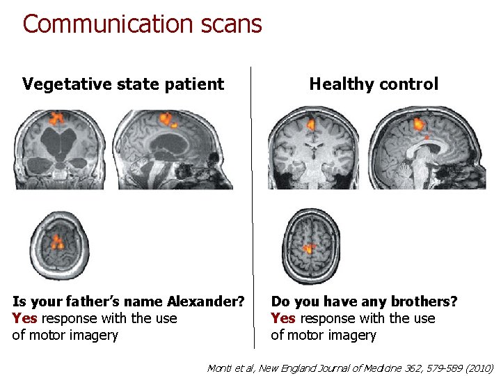 Communication scans Vegetative state patient Is your father’s name Alexander? Yes response with the Communication scans Vegetative state patient Is your father’s name Alexander? Yes response with the