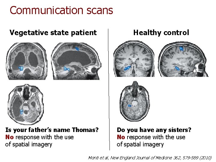 Communication scans Vegetative state patient Is your father’s name Thomas? No response with the Communication scans Vegetative state patient Is your father’s name Thomas? No response with the