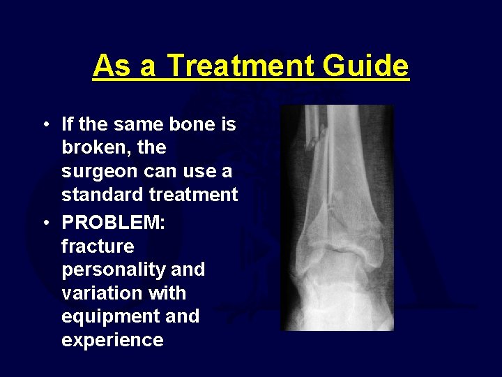 As a Treatment Guide • If the same bone is broken, the surgeon can