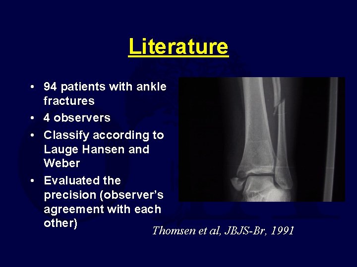 Literature • 94 patients with ankle fractures • 4 observers • Classify according to