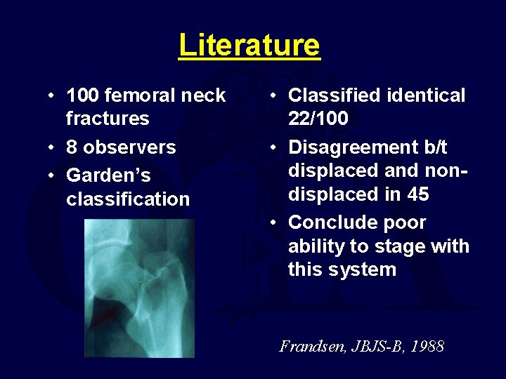 Literature • 100 femoral neck fractures • 8 observers • Garden’s classification • Classified