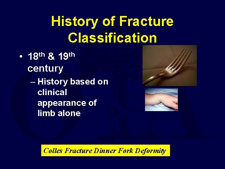 History of Fracture Classification • 18 th & 19 th century – History based