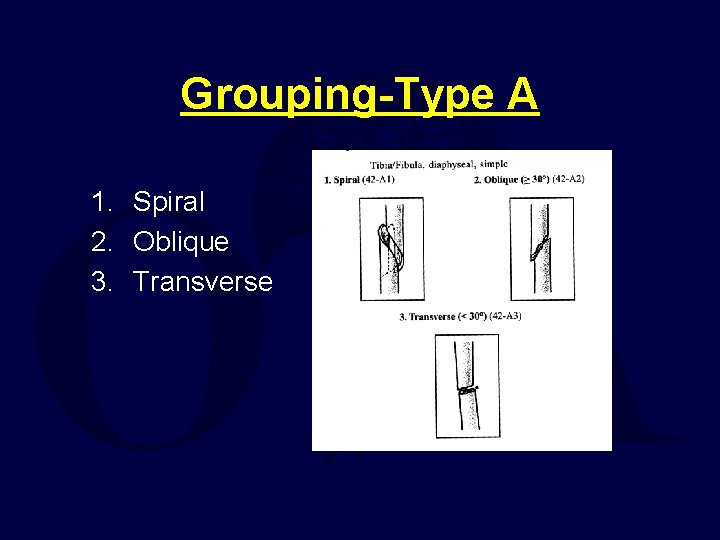 Grouping-Type A 1. Spiral 2. Oblique 3. Transverse 