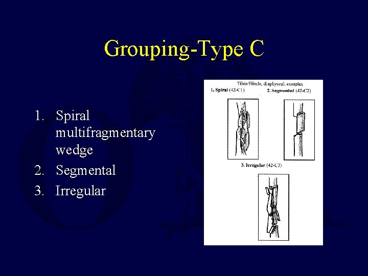 Grouping-Type C 1. Spiral multifragmentary wedge 2. Segmental 3. Irregular 