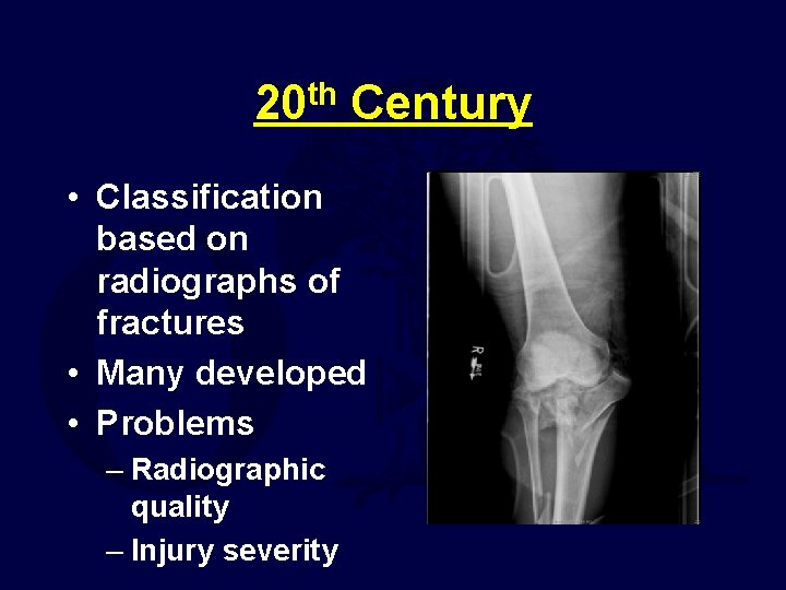 20 th Century • Classification based on radiographs of fractures • Many developed •