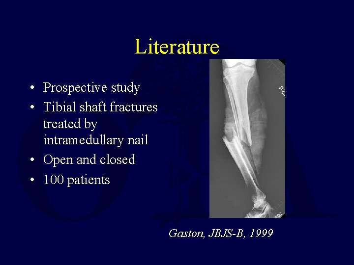 Literature • Prospective study • Tibial shaft fractures treated by intramedullary nail • Open