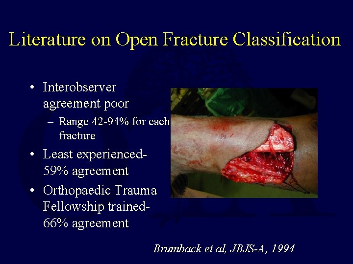 Literature on Open Fracture Classification • Interobserver agreement poor – Range 42 -94% for