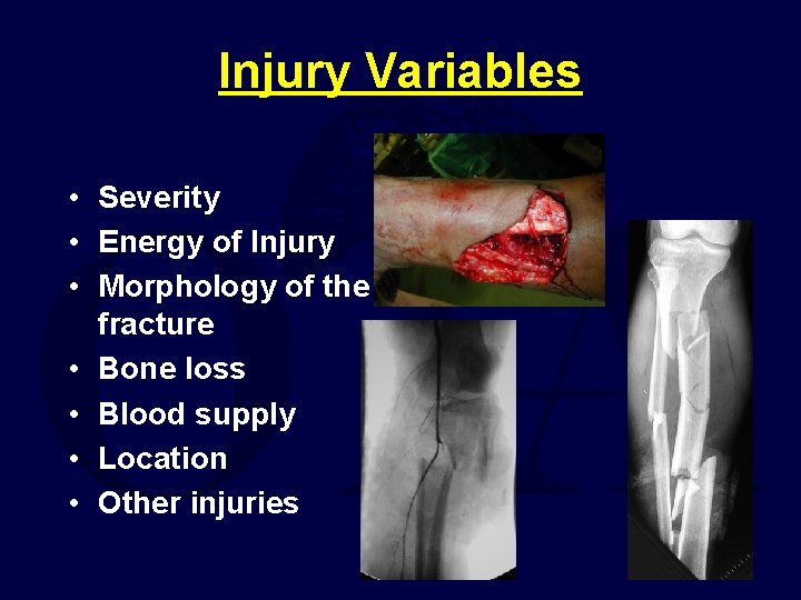 Injury Variables • Severity • Energy of Injury • Morphology of the fracture •