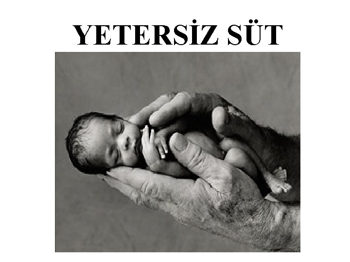 YETERSİZ SÜT 