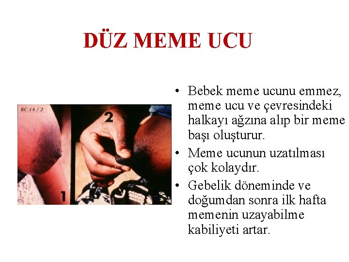 DÜZ MEME UCU • Bebek meme ucunu emmez, meme ucu ve çevresindeki halkayı ağzına