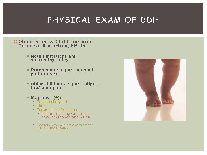 PHYSICAL EXAM OF DDH Older Infant & Child: perform Galeazzi, Abduction, ER, IR §