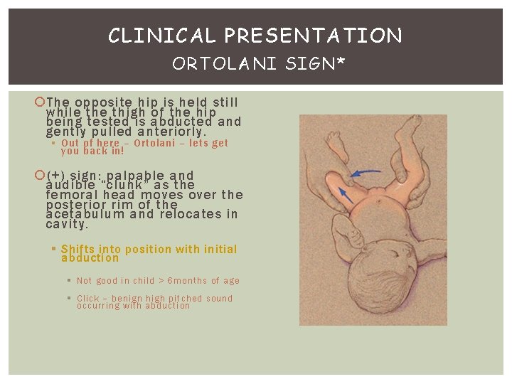 CLINICAL PRESENTATION ORTOLANI SIGN* The opposite hip is held still while thigh of the