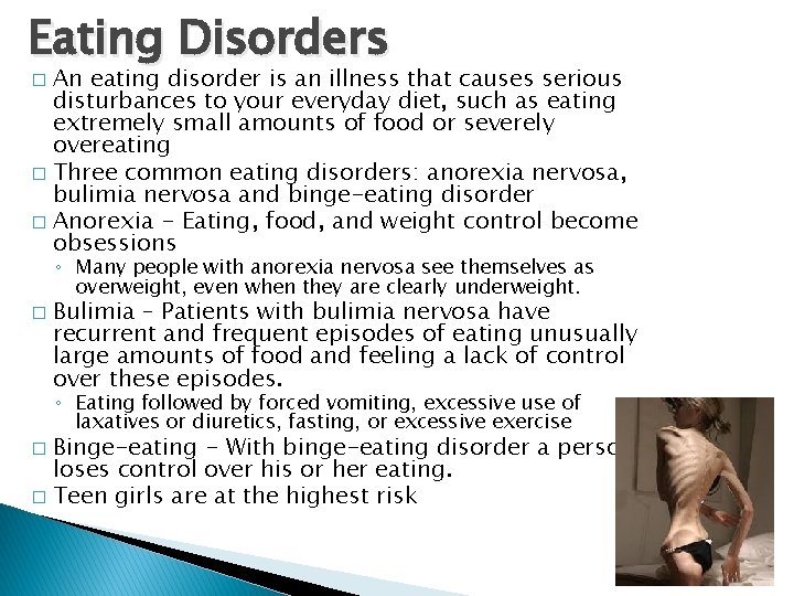 Eating Disorders An eating disorder is an illness that causes serious disturbances to your