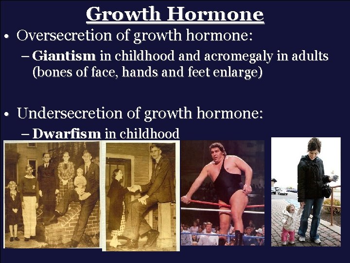 Growth Hormone • Oversecretion of growth hormone: – Giantism in childhood and acromegaly in