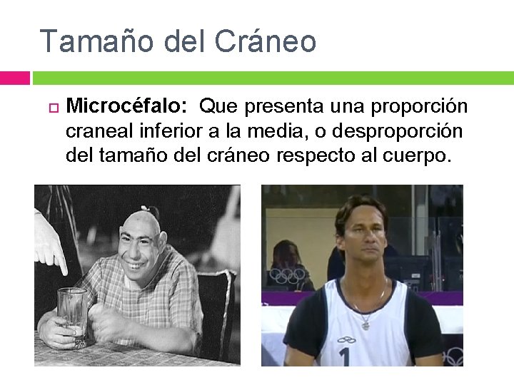 Tamaño del Cráneo Microcéfalo: Que presenta una proporción craneal inferior a la media, o