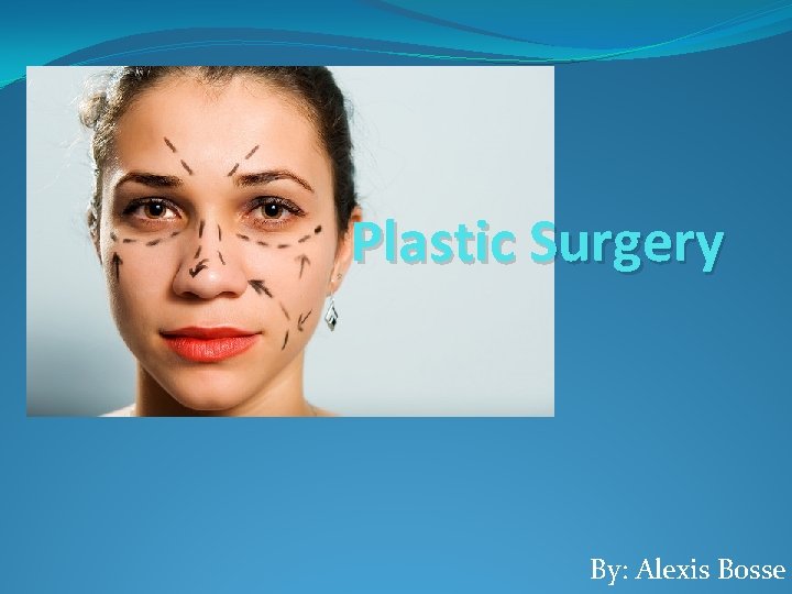 Plastic Surgery By: Alexis Bosse 