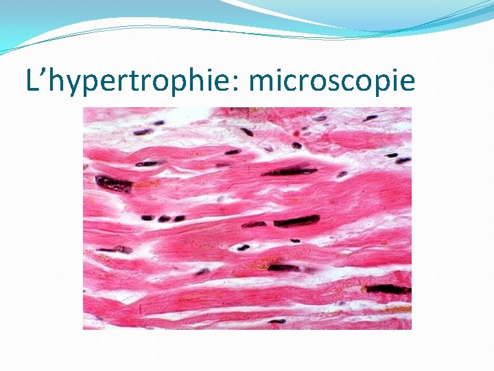 L’hypertrophie: microscopie 