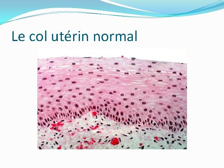 Le col utérin normal 