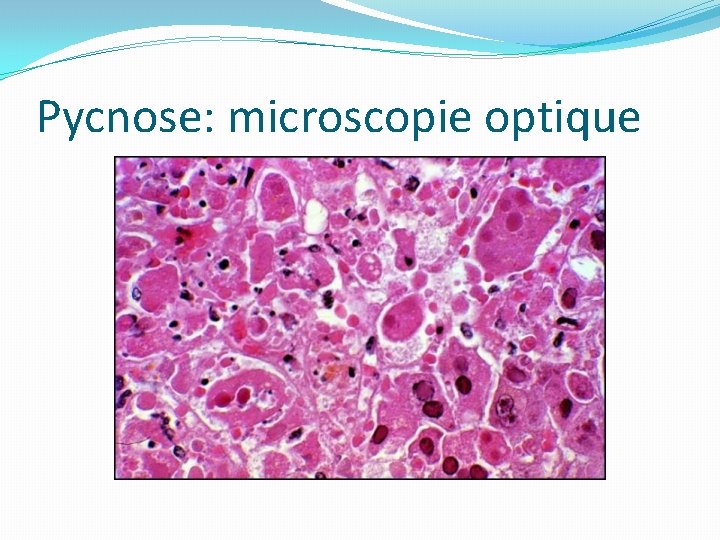 Pycnose: microscopie optique 