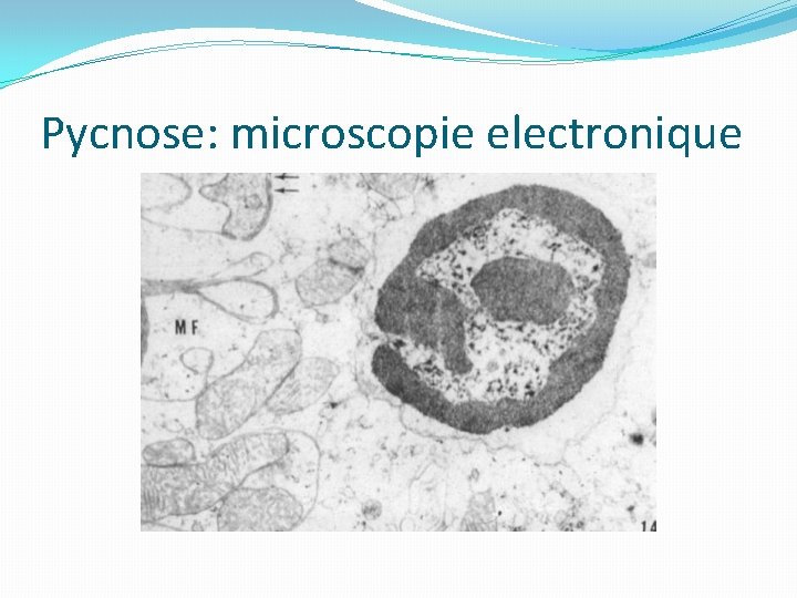 Pycnose: microscopie electronique 