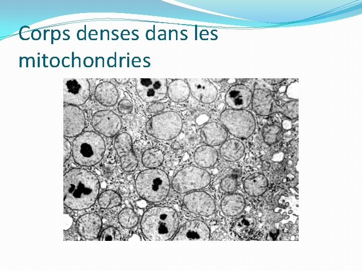 Corps denses dans les mitochondries 
